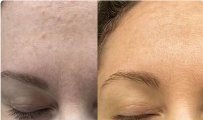 Before and After